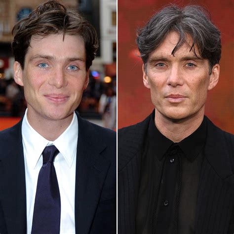 cillian murphy plastic surgery